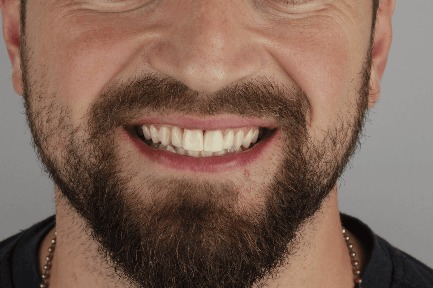 Kuzanov Dent clinic — smile transformations and interior