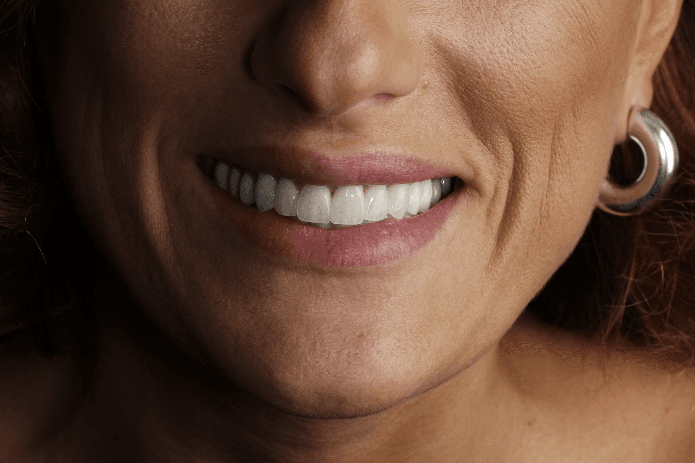 Kuzanov Dent clinic — smile transformations and interior