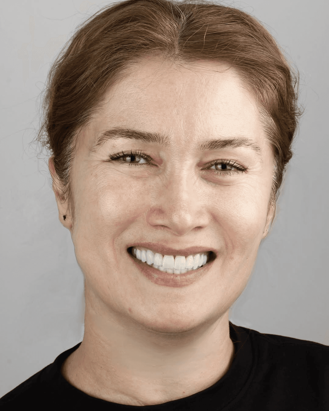 Kuzanov Dent clinic — smile transformations and interior